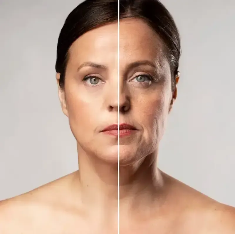 Ilustração do procedimento Bioestimulador Facial