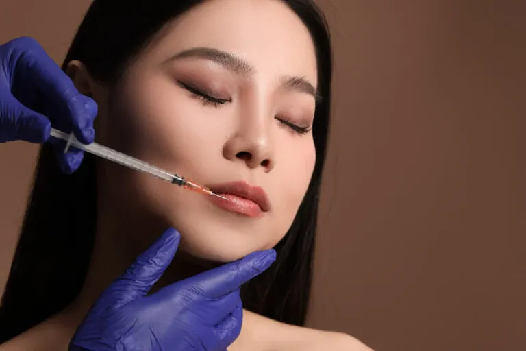 Ilustração do procedimento Preenchimento Labial